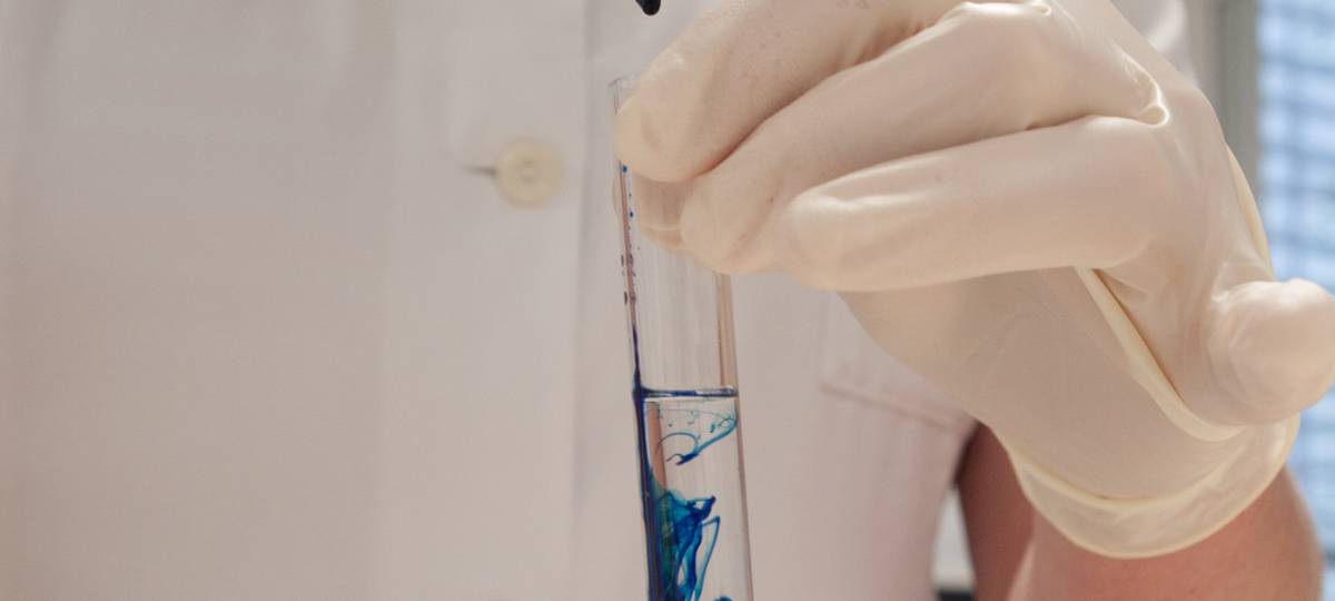 Corona-Tests in Fleischbetrieben bislang negativ