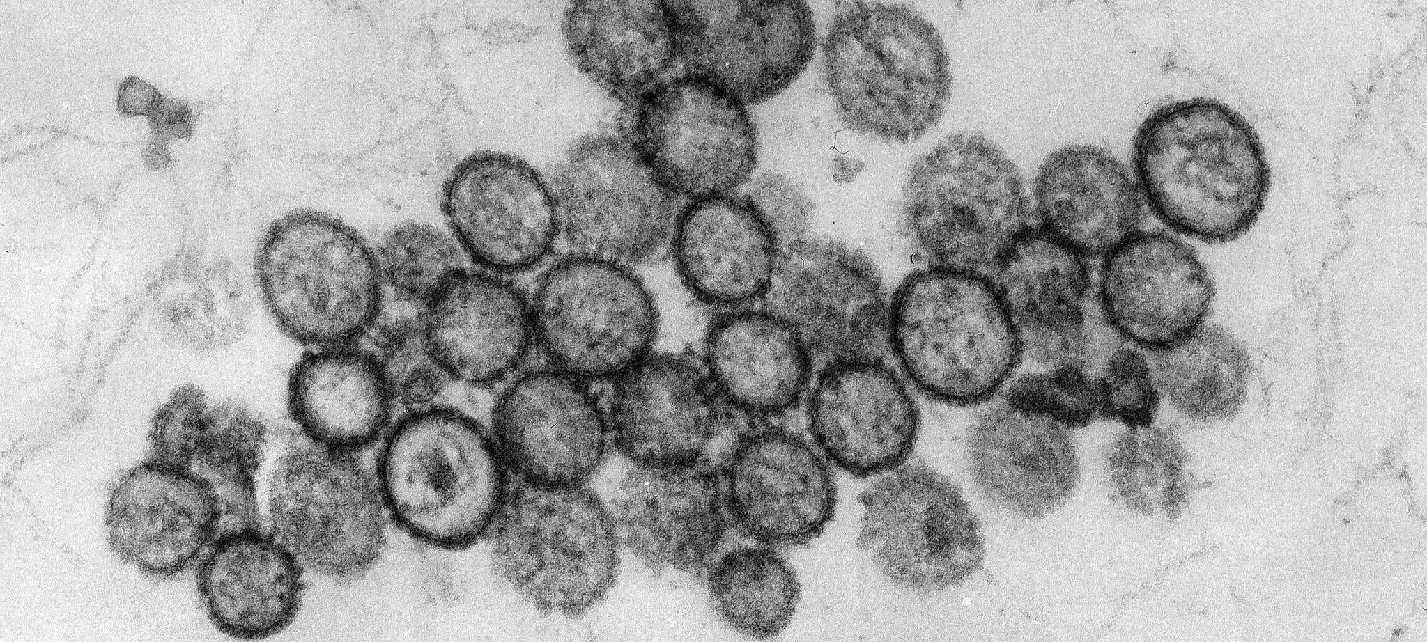 Hantavirus