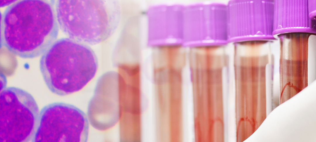 Kleine Spende - große Wirkung